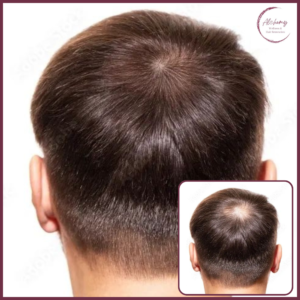 Density Enhancement 6 (1)